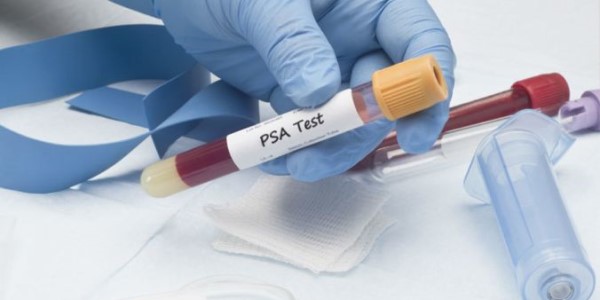Badanie poziomu PSA z krwi