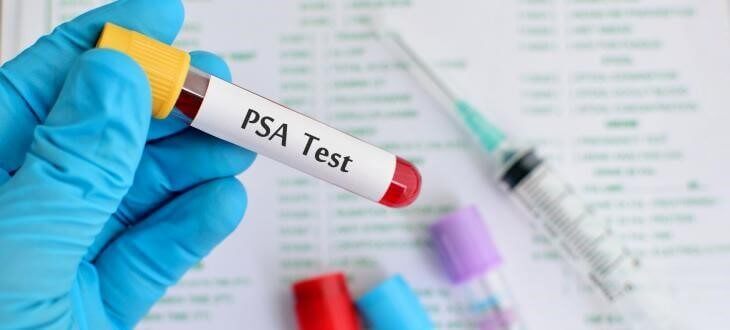 Test rapid calitativ PSA – casetă (sânge integral/ser/plasmă) – kit cu 10 teste