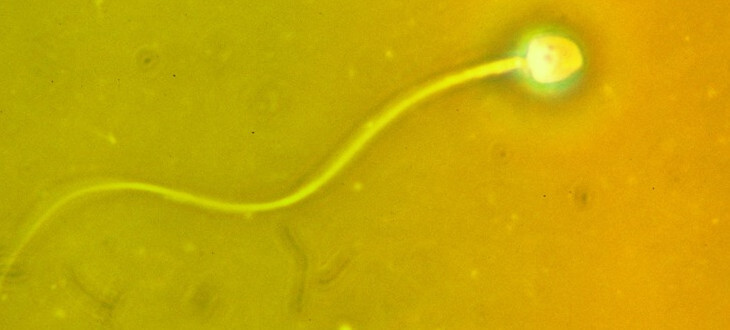 Barwa zielona i żółta sperma 